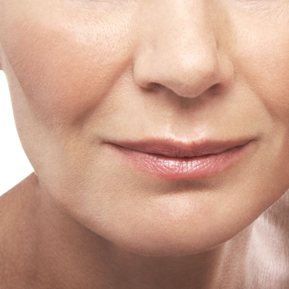 Dermal fillers image 1