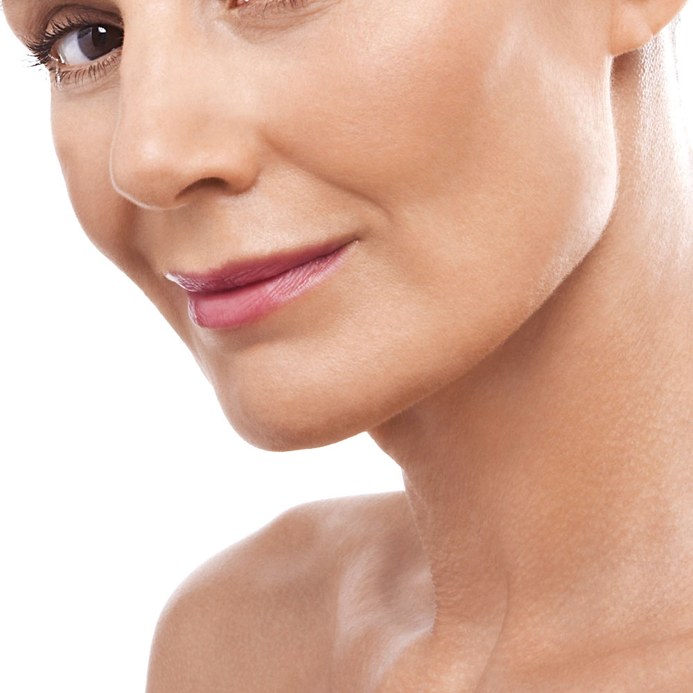 Non surgical facelifts image 1